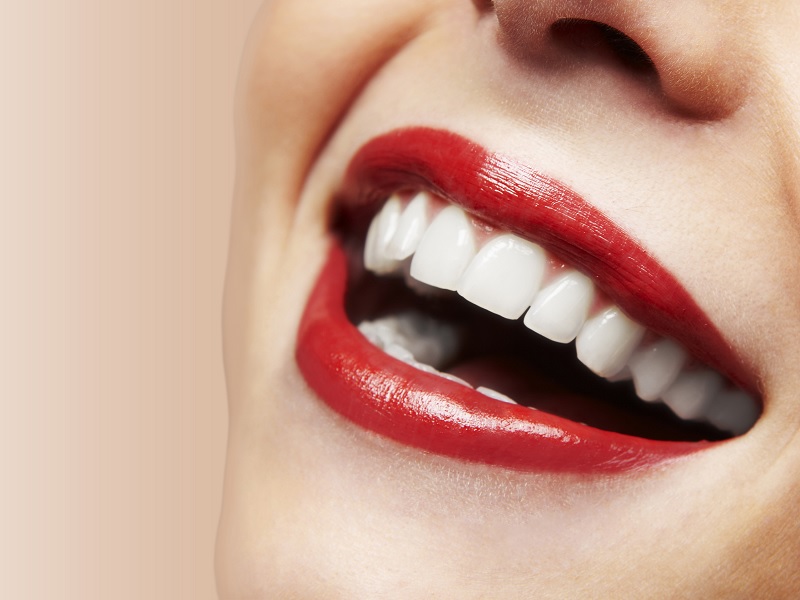 Tips Memutihkan Gigi Secara Alami