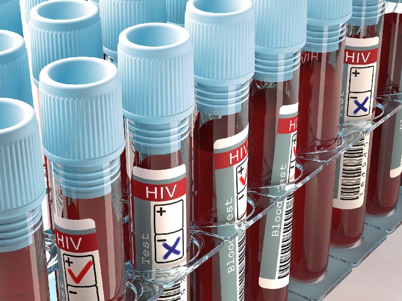 Cara Paling Efektif Untuk Mencegah Penularan HIV